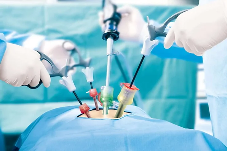 Advanced General Surgery